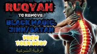 Ruqyah A Valid Method for Healing All Illnesses Bodily Ailments [upl. by Gen]