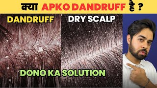 Say Goodbye to Dandruff or Dry Scalp HONEST SOLUTIONS [upl. by Longtin]