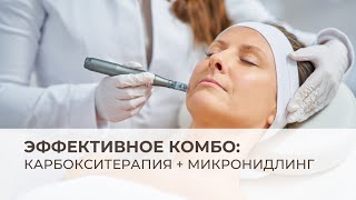 Эффективное комбо для косметологов максимум от карбокситерапии и микронидлинга [upl. by Annotahs]