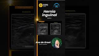 Hernia inguinal y ecografía con Ana de Groot Parte 1 ecografia fisioterapia [upl. by Atinit]