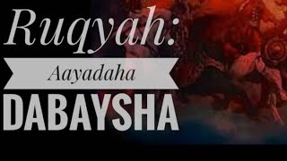 Ruqyah Aayadaha dabaysha iyo Cilaajka sixirka hawada [upl. by Elamor]