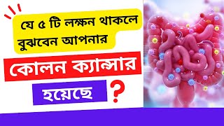 The 5 Most Common Colon Cancer Symptoms কোলন ক্যান্সারের ৫ টি প্রাথমিক লক্ষণগুলি উপেক্ষা করবেন না। [upl. by Sidky]