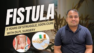 3 Years of Pain Ends How DLPL Surgery in India Cured My Fistula  Mr Rahuls Story [upl. by Manvil346]