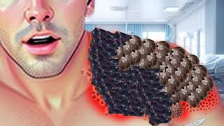 ASMR removes maggots and dog fleas arms infected by bees become infected trypophobia [upl. by Katey804]