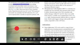 Kanski Clinical Ophthalmology Made Easy  Glaucoma 5 [upl. by Lefton]