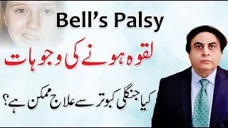 Bells Palsy  Laqwa ka Ilaj  Facial Paralysis Causes amp Treatment By Dr Khalid Jamil [upl. by Ailb834]