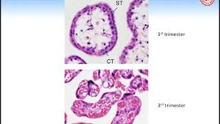 Grand Rounds Endocrinology of the MaternalFetalPlacental Unit [upl. by Jarlath403]