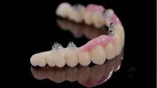 K Dental LabZirkonzahn PrettauImplant screwretained bridge1mov [upl. by Bakki]