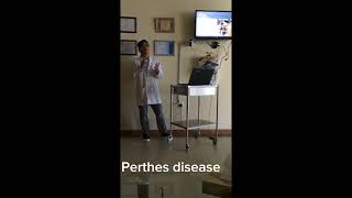 Perthes Disease in Children Legg Perthes Disease [upl. by Nygem]