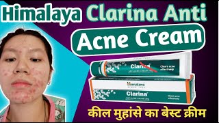 Himalaya Clarina Anti Acne Cream कील मुहांसे को जड़ से खत्म करे। 100 आयुर्वेदिक पिंपल मुहासा क्रीम [upl. by Briggs]