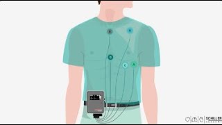 SCHILLER Holter Monitoring [upl. by Sholom]