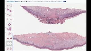 3 hours of straight dermpath [upl. by Philoo]