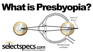 What is Presbyopia With SelectSpecscom [upl. by Alyad124]