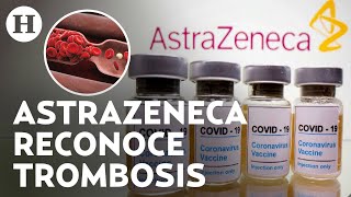 ¿Qué es y cuáles son los síntomas de la trombosis enfermedad ligada a la vacuna de AstraZeneca [upl. by Mclyman]