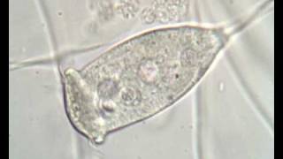 Vorticella sp in activated sludge [upl. by Enyehc]