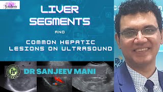 LIVER SEGMENTS amp COMMON HEPATIC LESIONS ON ULTRASOUND  DR SANJEEV MANI  LIVER ULTRASOUND TIPS [upl. by Amsab]