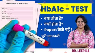 HbA1c Test Kya Hota Hai Kyu Hota Hai HbA1c Test Report Kaise Padhe Puri Jankari [upl. by Marutani514]