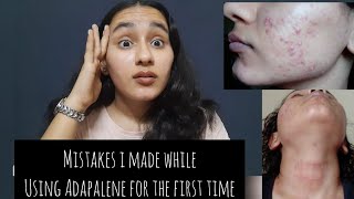 My Adapalene mistakes Using too much product  Irritationrednessdry skin Khushi Mahla [upl. by Erme130]