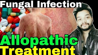 Fungal infection Allopathic Treatment In Hindi  Gyanear [upl. by Parette]