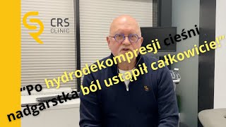 Po hydrodekompresji cieśni nadgarstka ból ustąpił całkowicie [upl. by Zetnom]