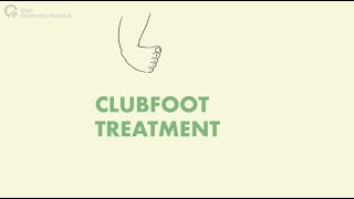 Clubfoot Treatment [upl. by Nations6]