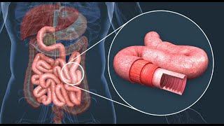 Comprendre L absorption intestinale  SVT [upl. by Tillman]