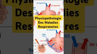 Physiopathologie Maladies Respiratoires pneumologie bronchite asthme fibrosepulmonaire poumon [upl. by Ary]