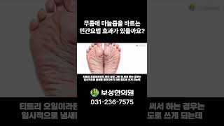 무좀에 마늘즙을 바르는 민간요법 효과가 있을까요 [upl. by Ax15]