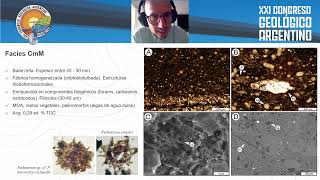 SEM study of mud aggregates within earlydiagenetic carbonate concretions [upl. by Loggia]