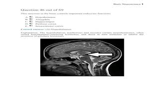 SCE MRCP Questions Update in Neurology From BoardVitals [upl. by Filmer163]