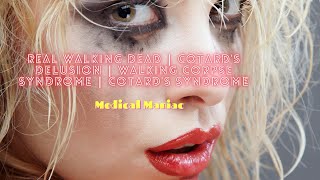 Real Walking Dead  walking corpse syndrome  Cotards syndrome  People Believe They are Dead [upl. by Nitaj]