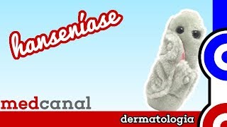 Hanseníase  DERMATOLOGIA [upl. by Quita]