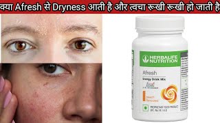 Winters में Afresh लेने से क्या Dryness आती है  ओर dryness दूर करने के उपाय [upl. by Vonnie808]