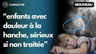 Clinique PSB  Douleur hanche enfant Épiphysiolyse fémorale supérieure [upl. by Cutter]