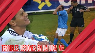 LAS PEORES LESIONES EN LA HISTORIA DE LA LIGA MX 💀⚽😵 [upl. by Satsok]