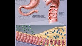 Clostridium Difficile [upl. by Llenehc]