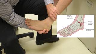 Ankle Pain  Everything You Need To Know  Dr Nabil Ebraheim [upl. by Nimesay]