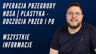 Operacja przegrody nosa  Plastyka nosa  Zatoki  odczucia przed i po [upl. by Redleh]