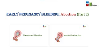 EARLY PREGNANCY BLEEDING THREATEND ABORTION INEVITABLE ABORTION PART 2 [upl. by Ennis331]