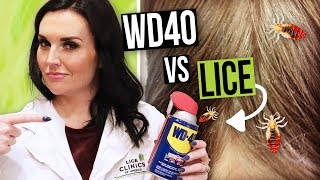 Removing Head Lice with WD40  Watch this BEFORE you Try [upl. by Ubana987]