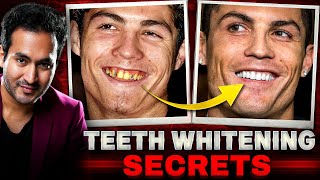 Celebrity TEETH WHITENING Secrets Revealed  Whiten 20 Shades in 1 Week [upl. by Shelly740]