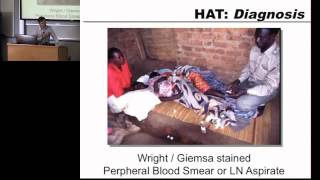 Trypanosomiasis Leishmaniasis Chagas Part 1  2013 Global Health Disasters Course [upl. by Lois]