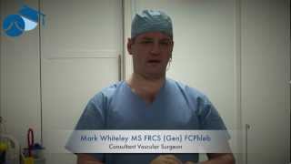 Explanation of foam sclerotherapy for varicose veins [upl. by Elkraps]