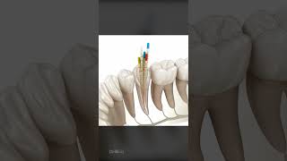 What To Expect During a Root Canal Is It Right For You [upl. by Krahling]