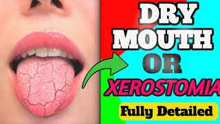 CAUSES OF XEROSTOMIA  MANGEMENT  DRY MOUTH 😍 [upl. by Onairam734]