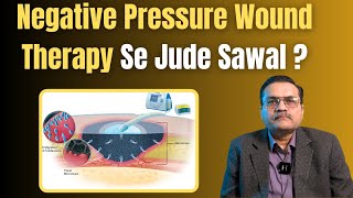 Negative Pressure Would Therapy Myths  कितना समय लगता है दर्द कितना होता है पूरी तरह ठीक होता है [upl. by Semyaj405]