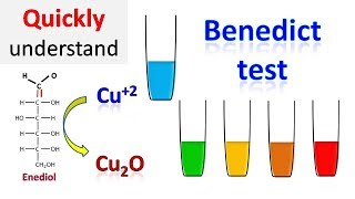 Benedicts test [upl. by Hartmann]