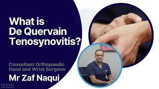 What is De Quervain tenosynovitis [upl. by Frederiksen850]