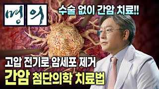 간암 치료의 혁명 3천 볼트 전기로 간암 치료를  2024 국내 최초 전기천공법 간암 시술 성공  암세포만 골라 죽이는 방사선 색전술  EBS 명의 [upl. by Millard]