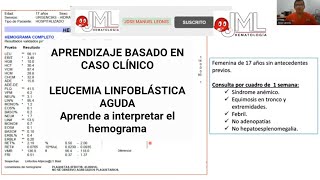 LEUCEMIA LINFOBLÁSTICA AGUDA B APRENDIZAJE BASADO EN CASOleucemia medicinahematologia [upl. by Aivlis]